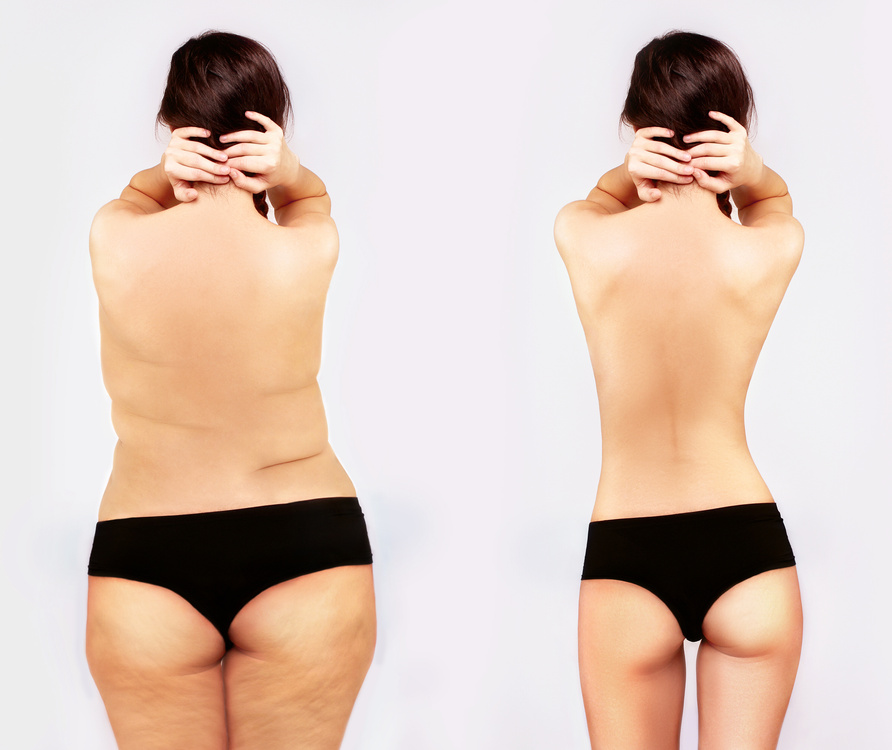 Fat girl standing next to a skinny one